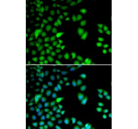 Immunofluorescence - RPS6KA3 antibody from Signalway Antibody (38655) - Antibodies.com