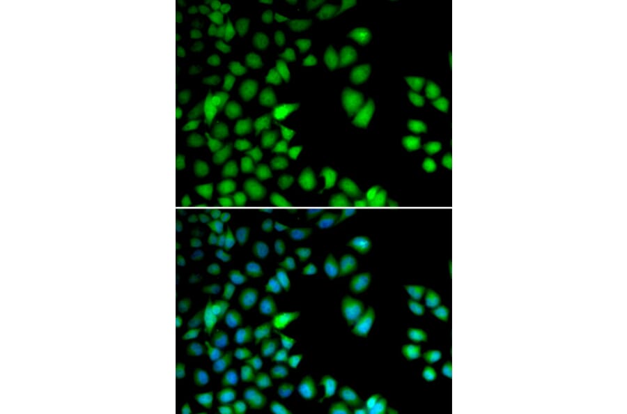 Immunofluorescence - RPS6KA3 antibody from Signalway Antibody (38655) - Antibodies.com