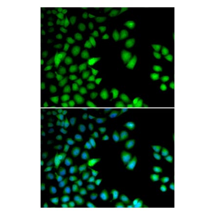 Immunofluorescence - RPS6KA3 antibody from Signalway Antibody (38655) - Antibodies.com