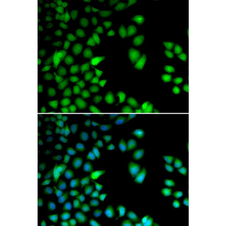 Immunofluorescence - RPS6KA3 antibody from Signalway Antibody (38655) - Antibodies.com