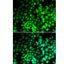 Immunofluorescence - ST6GAL1 antibody from Signalway Antibody (38688) - Antibodies.com