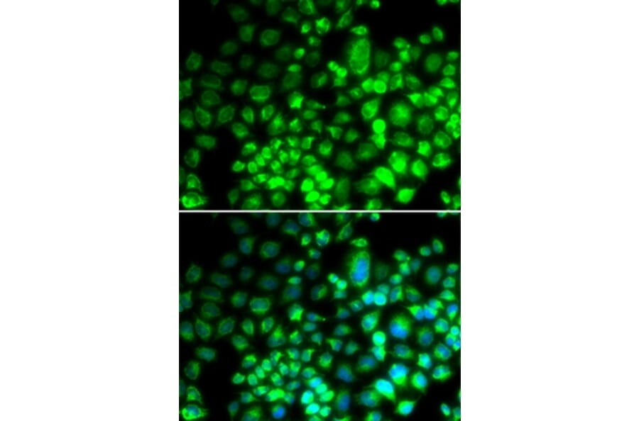 Immunofluorescence - ST6GAL1 antibody from Signalway Antibody (38688) - Antibodies.com