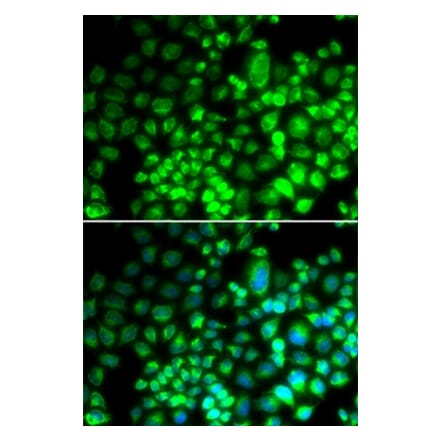 Immunofluorescence - ST6GAL1 antibody from Signalway Antibody (38688) - Antibodies.com