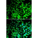 Immunofluorescence - ST6GAL1 antibody from Signalway Antibody (38688) - Antibodies.com