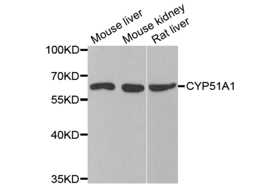 Western blot - CYP51A1 antibody from Signalway Antibody (38778) - Antibodies.com