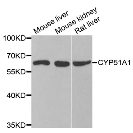 Western blot - CYP51A1 antibody from Signalway Antibody (38778) - Antibodies.com