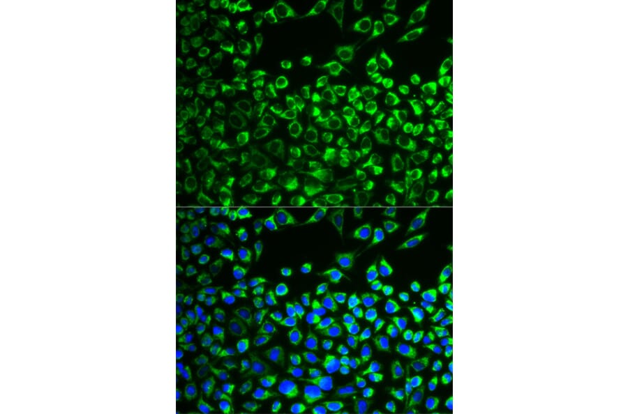 Immunofluorescence - CYP51A1 antibody from Signalway Antibody (38778) - Antibodies.com