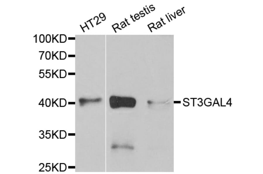 Western blot - ST3GAL4 antibody from Signalway Antibody (38813) - Antibodies.com