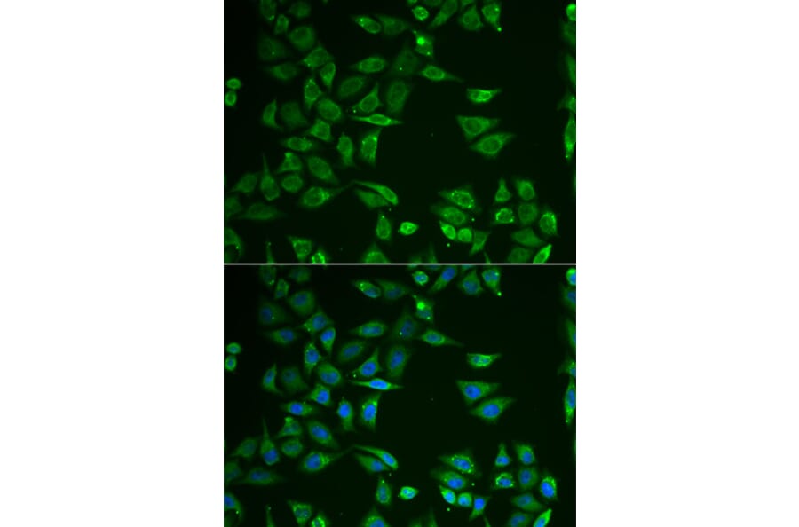 Immunofluorescence - ST3GAL4 antibody from Signalway Antibody (38813) - Antibodies.com