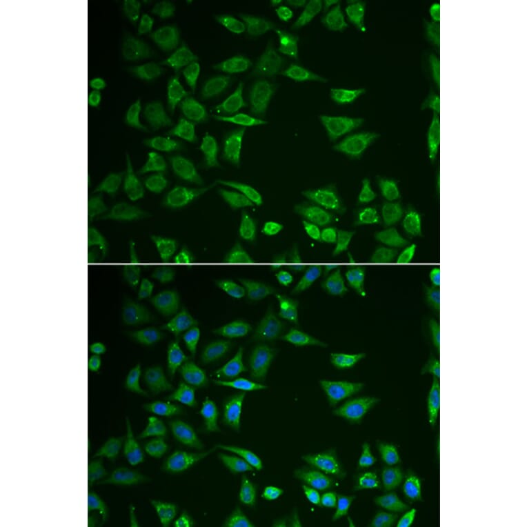Immunofluorescence - ST3GAL4 antibody from Signalway Antibody (38813) - Antibodies.com