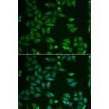 Immunofluorescence - ST3GAL4 antibody from Signalway Antibody (38813) - Antibodies.com