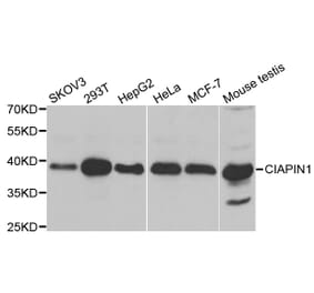 Western blot - CIAPIN1 antibody from Signalway Antibody (38835) - Antibodies.com