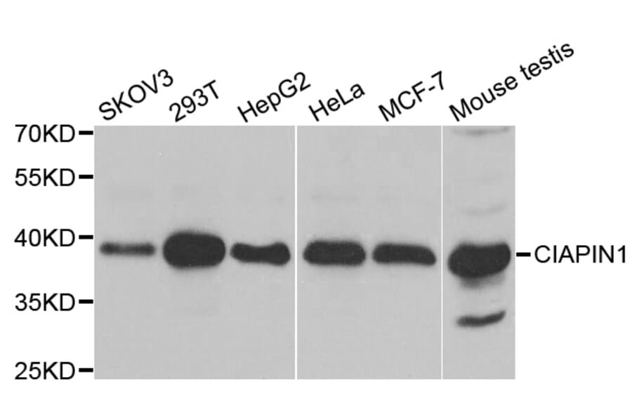 Western blot - CIAPIN1 antibody from Signalway Antibody (38835) - Antibodies.com