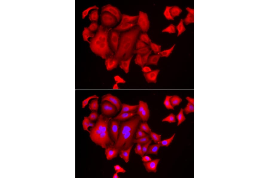 Immunofluorescence - SLC26A2 antibody from Signalway Antibody (38854) - Antibodies.com