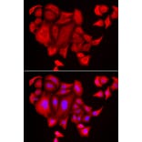 Immunofluorescence - SLC26A2 antibody from Signalway Antibody (38854) - Antibodies.com