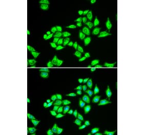 Immunofluorescence - TPD52L1 antibody from Signalway Antibody (38898) - Antibodies.com