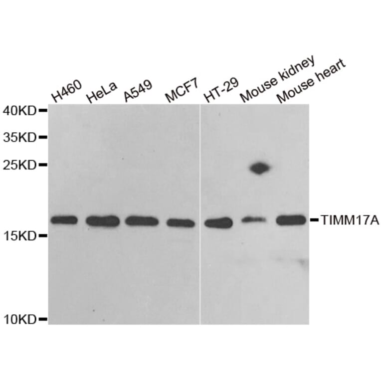 Western blot - TIMM17A antibody from Signalway Antibody (38927) - Antibodies.com