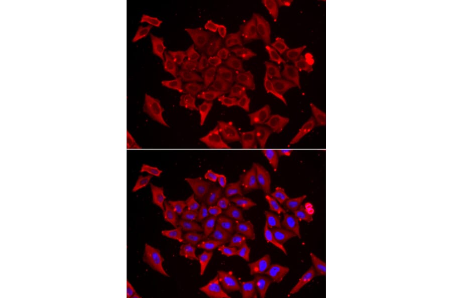 Immunofluorescence - TIMM17A antibody from Signalway Antibody (38927) - Antibodies.com