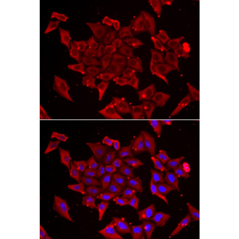 Immunofluorescence - TIMM17A antibody from Signalway Antibody (38927) - Antibodies.com