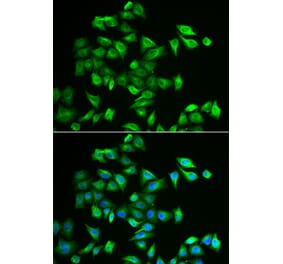 Immunofluorescence - POMGNT2 antibody from Signalway Antibody (38956) - Antibodies.com