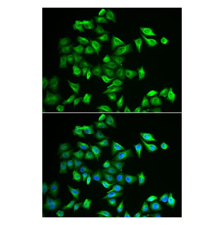 Immunofluorescence - POMGNT2 antibody from Signalway Antibody (38956) - Antibodies.com