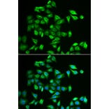 Immunofluorescence - POMGNT2 antibody from Signalway Antibody (38956) - Antibodies.com