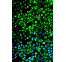 Immunofluorescence - ATP6AP2 antibody from Signalway Antibody (38984) - Antibodies.com