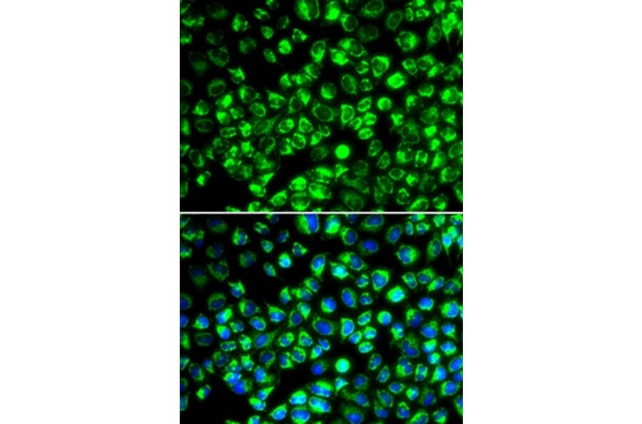 Immunofluorescence - ATP6AP2 antibody from Signalway Antibody (38984) - Antibodies.com