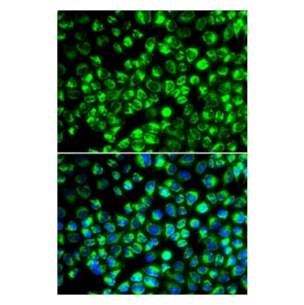 Immunofluorescence - ATP6AP2 antibody from Signalway Antibody (38984) - Antibodies.com