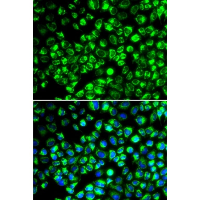 Immunofluorescence - ATP6AP2 antibody from Signalway Antibody (38984) - Antibodies.com