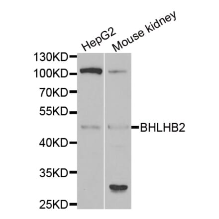 Western blot - BHLHE40 antibody from Signalway Antibody (38987) - Antibodies.com