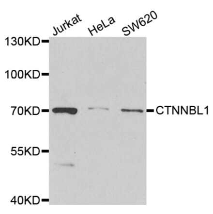 Western blot - CTNNBL1 antibody from Signalway Antibody (39017) - Antibodies.com