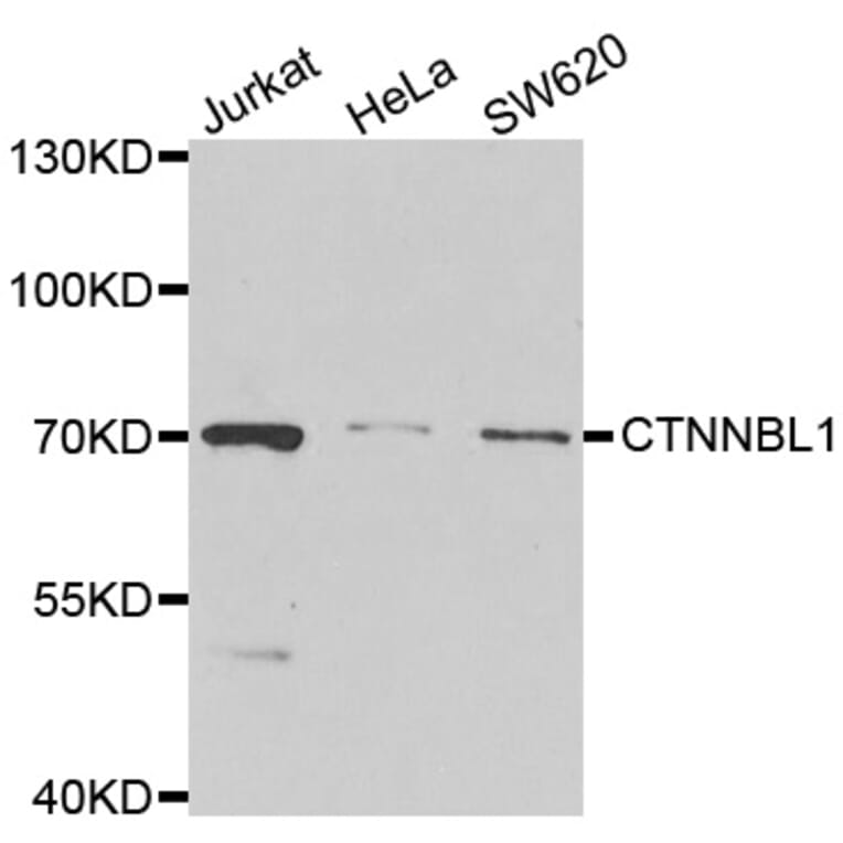 Western blot - CTNNBL1 antibody from Signalway Antibody (39017) - Antibodies.com