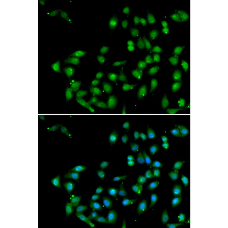Immunofluorescence - CTNNBL1 antibody from Signalway Antibody (39017) - Antibodies.com