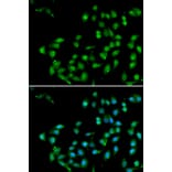 Immunofluorescence - CTNNBL1 antibody from Signalway Antibody (39017) - Antibodies.com