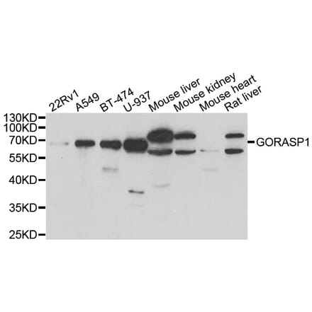 Western blot - GORASP1 antibody from Signalway Antibody (39041) - Antibodies.com