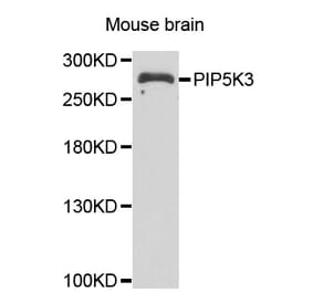 Western blot - PIKFYVE antibody from Signalway Antibody (39103) - Antibodies.com
