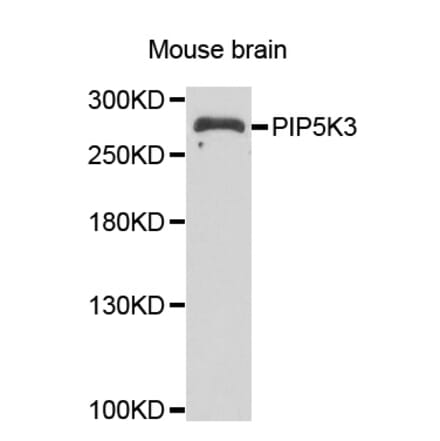 Western blot - PIKFYVE antibody from Signalway Antibody (39103) - Antibodies.com