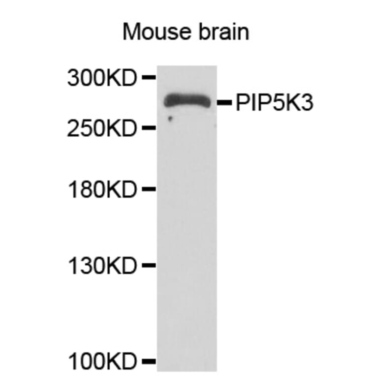 Western blot - PIKFYVE antibody from Signalway Antibody (39103) - Antibodies.com