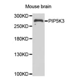 Western blot - PIKFYVE antibody from Signalway Antibody (39103) - Antibodies.com