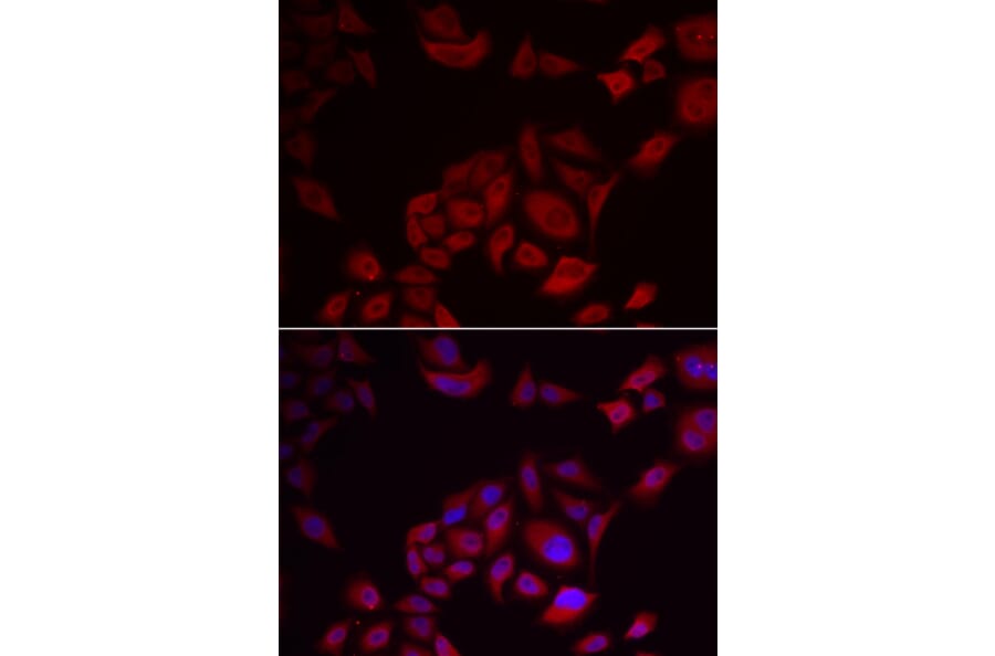 Immunofluorescence - PIKFYVE antibody from Signalway Antibody (39103) - Antibodies.com