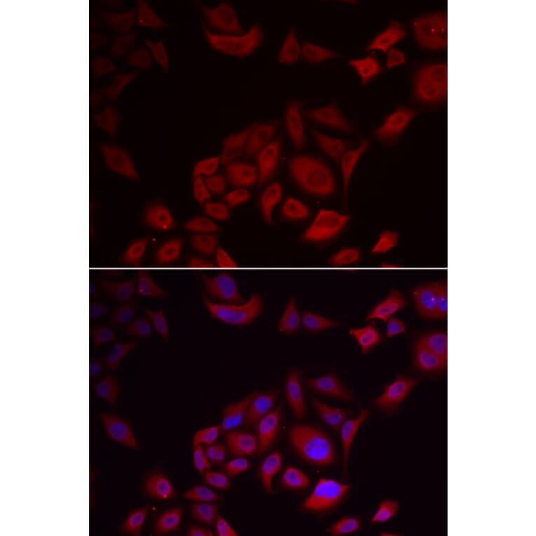 Immunofluorescence - PIKFYVE antibody from Signalway Antibody (39103) - Antibodies.com