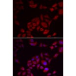 Immunofluorescence - PIKFYVE antibody from Signalway Antibody (39103) - Antibodies.com