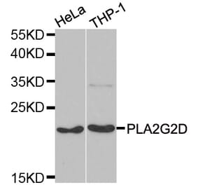 Western blot - PLA2G2D antibody from Signalway Antibody (39104) - Antibodies.com