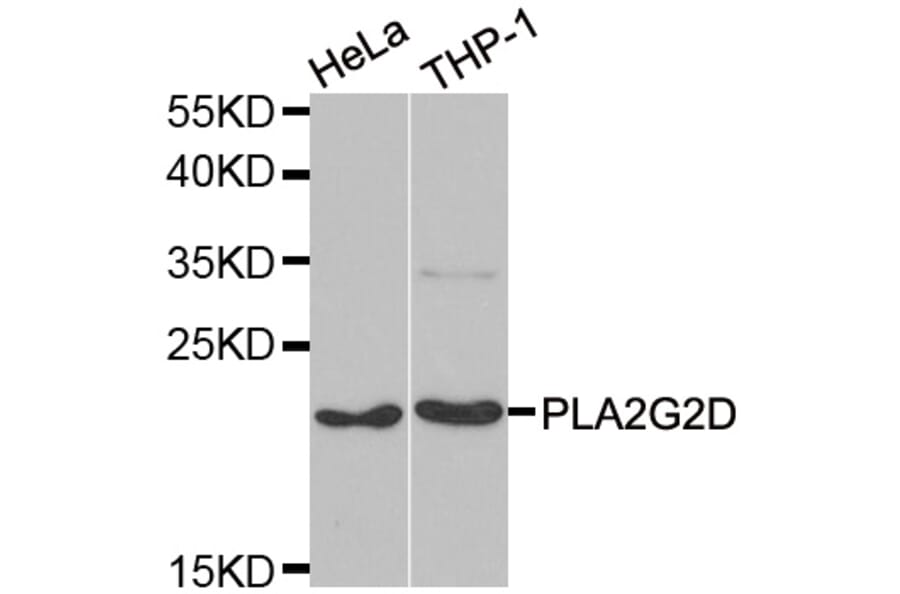 Western blot - PLA2G2D antibody from Signalway Antibody (39104) - Antibodies.com