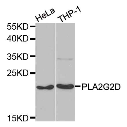 Western blot - PLA2G2D antibody from Signalway Antibody (39104) - Antibodies.com