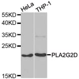 Western blot - PLA2G2D antibody from Signalway Antibody (39104) - Antibodies.com