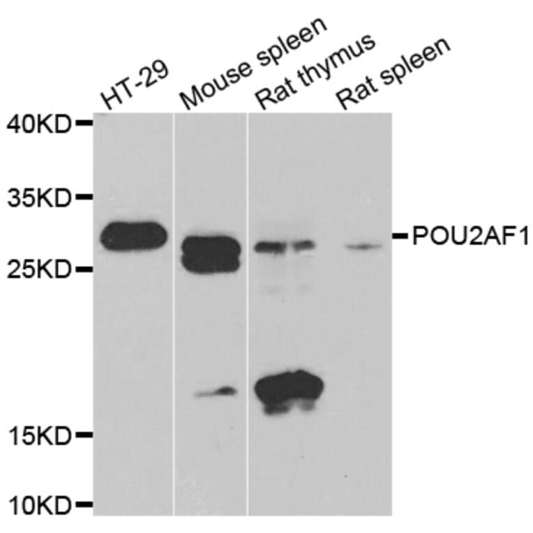 Western blot - POU2AF1 antibody from Signalway Antibody (39109) - Antibodies.com