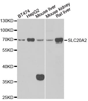 Western blot analysis of extracts of various cell lines, using SLC20A2 antibody.