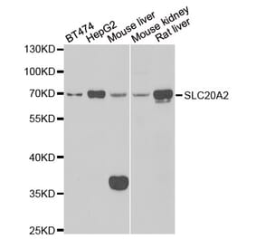 Western blot - SLC20A2 antibody from Signalway Antibody (39144) - Antibodies.com